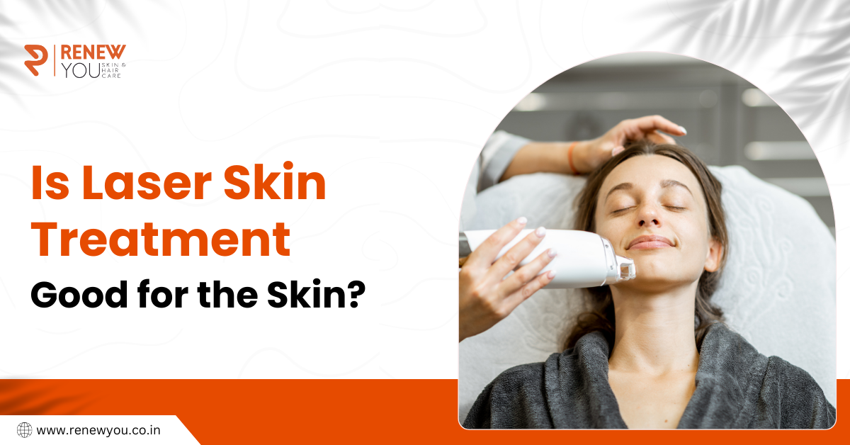 Is laser skin treatment good for the skin? 