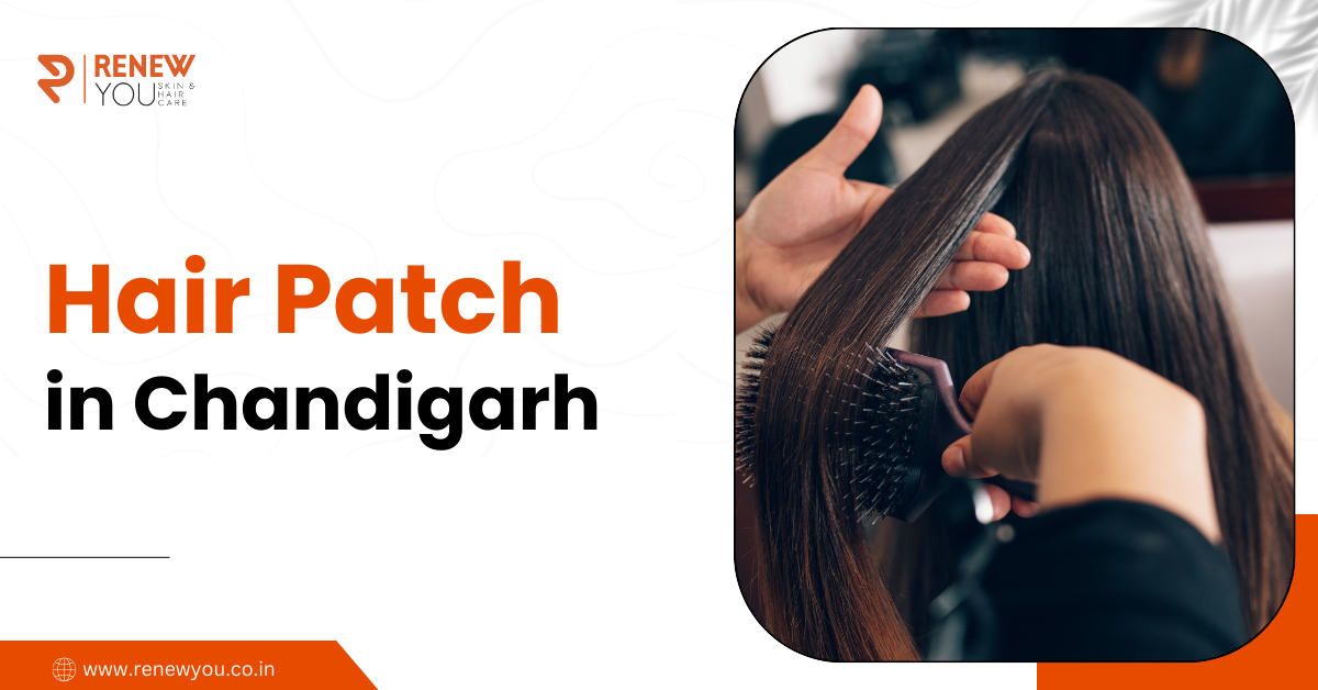 Hair Patch in Chandigarh