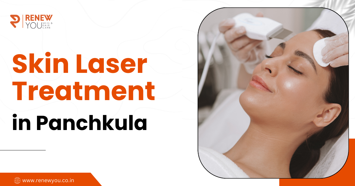 Skin Laser Treatment in Panchkula