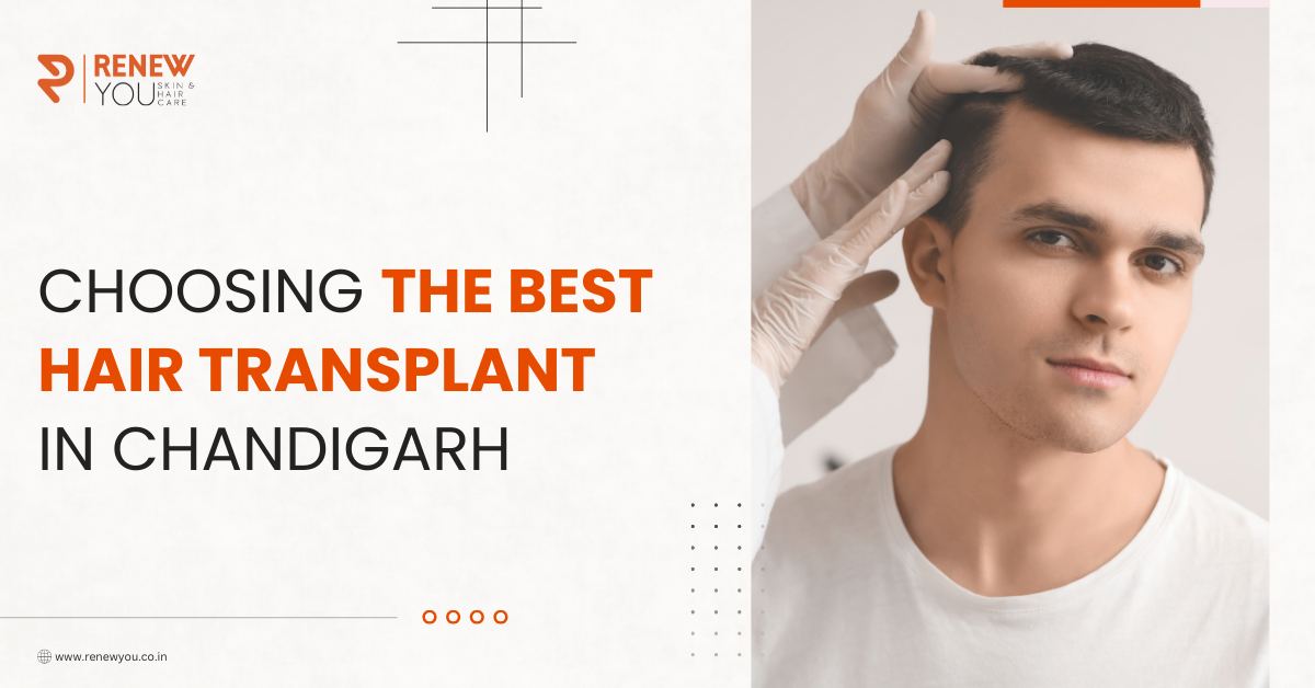 Hair transplant in Chandigarh