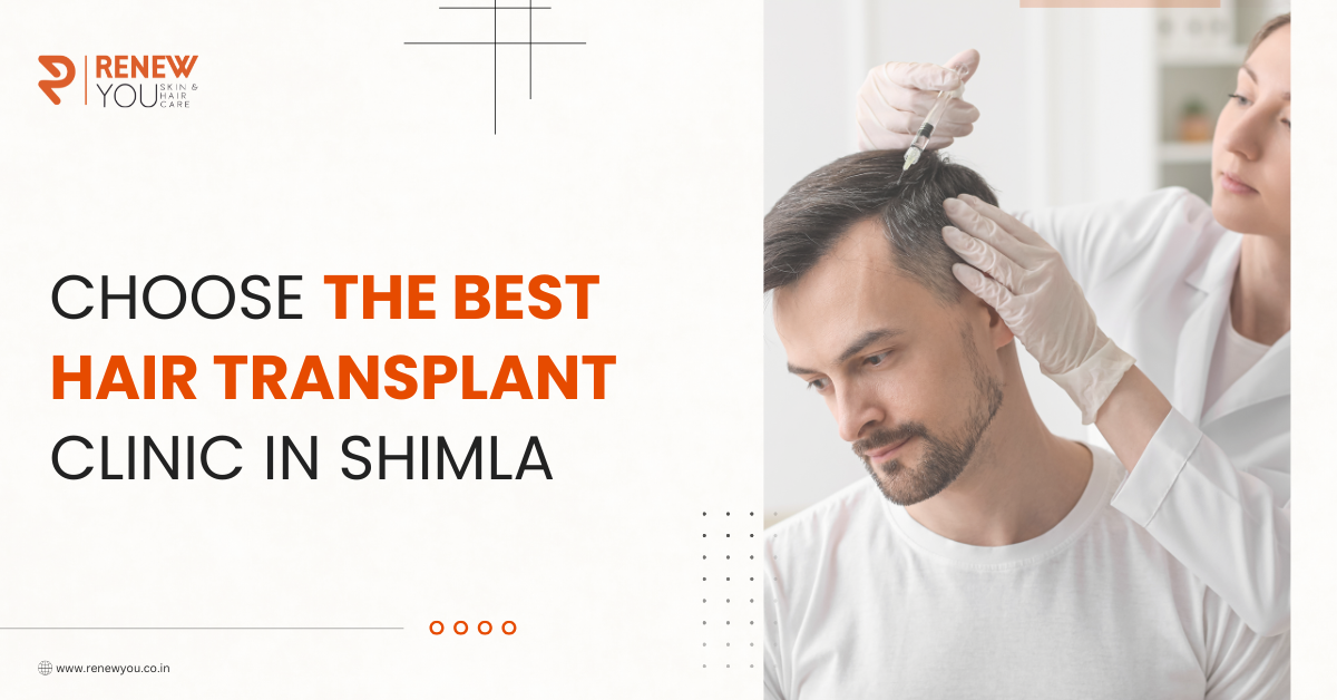 best Hair transplant in Shimla