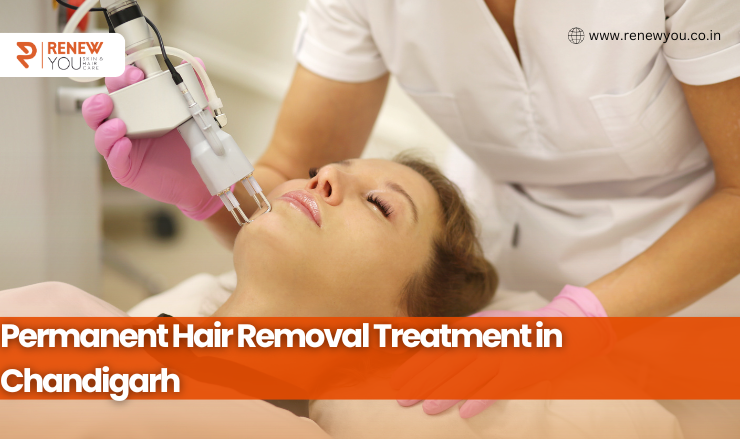 Permanent Hair Removal Treatment in Chandigarh