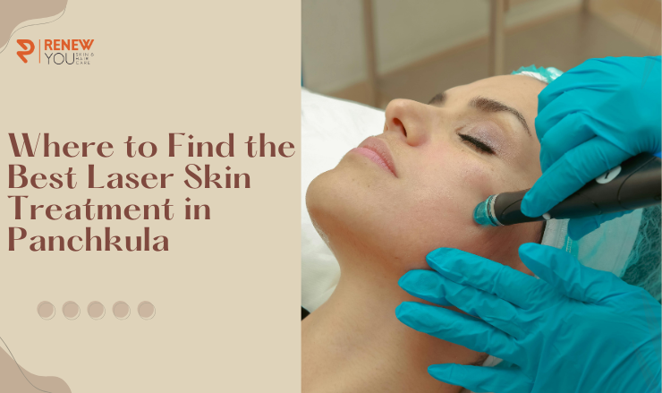 Where to Find the Best Laser Skin Treatment in Panchkula