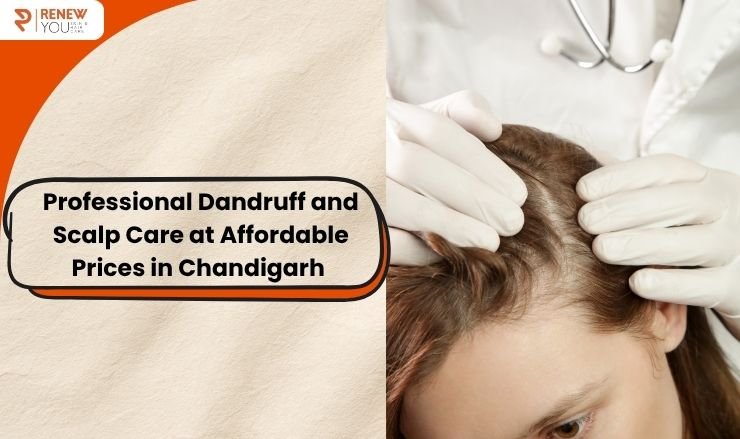 Professional Dandruff and Scalp Care at Affordable Prices in Chandigarh