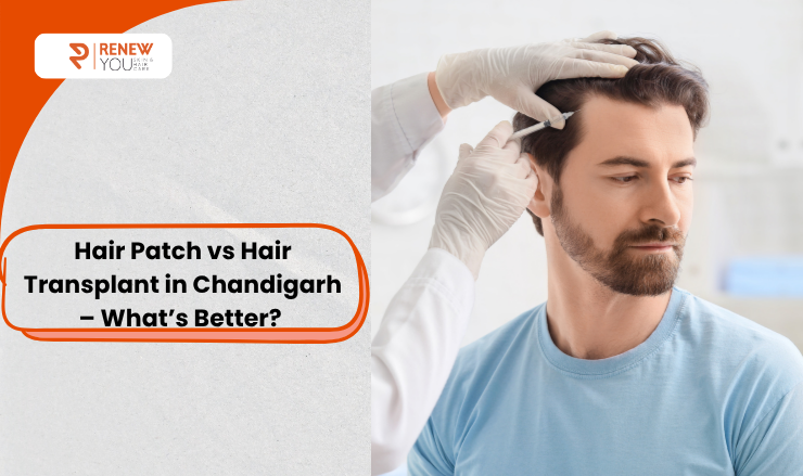 Hair Patch vs Hair Transplant in Chandigarh – What’s Better?