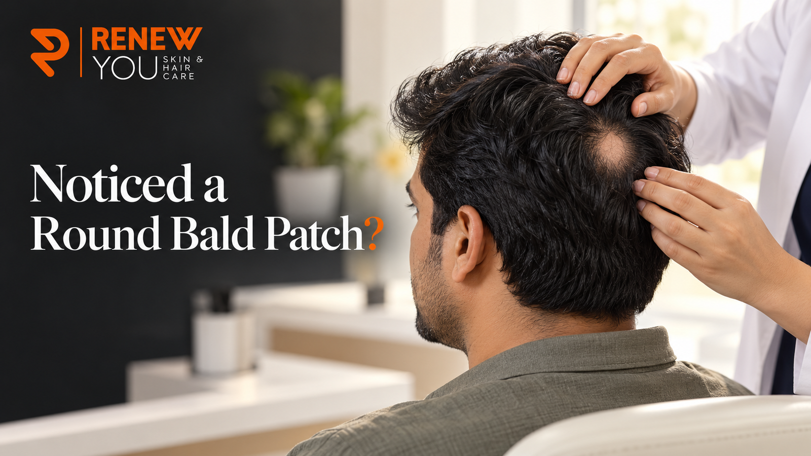Why Are Round Bald Patches Appearing on Your Scalp?